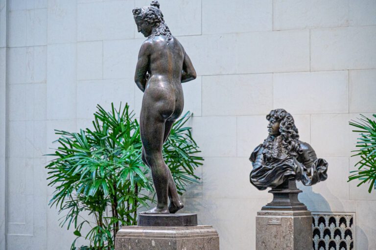 The Cosmetic Aspects of the Cleft Lift for Pilonidal Disease